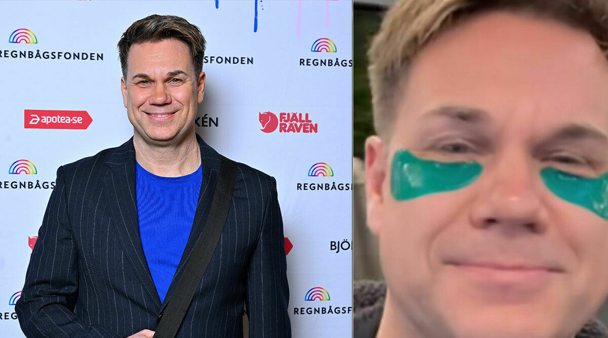 Nyhetsmorgon-stjärnan viker sig för hånen – gör ingrepp i ansiktet