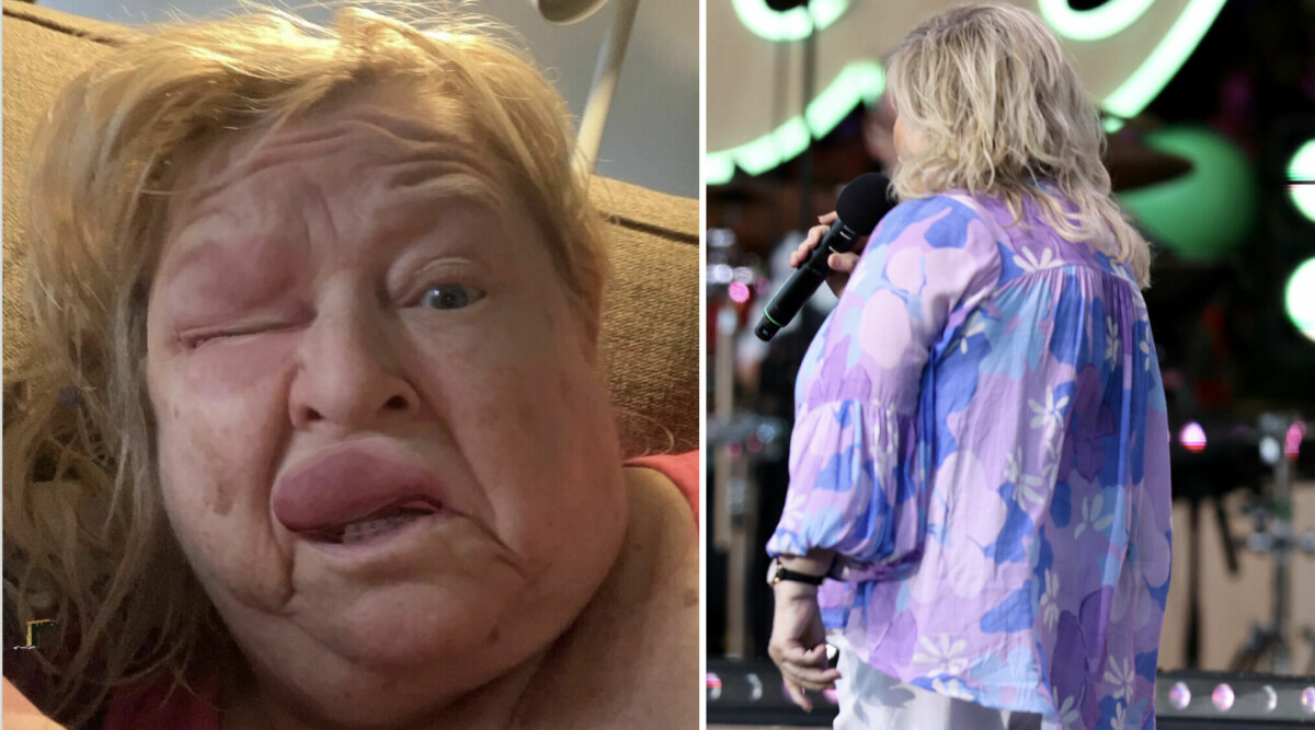 Kikki Danielsson chockar med sitt ansikte – nu träder hon fram