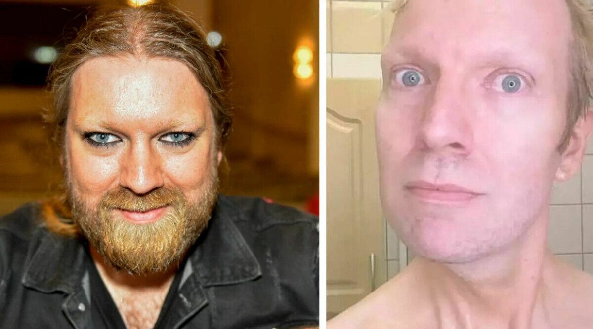 Rickard Söderberg avslöjar sanningen bakom förvandlingen: "Psykisk ohälsa"
