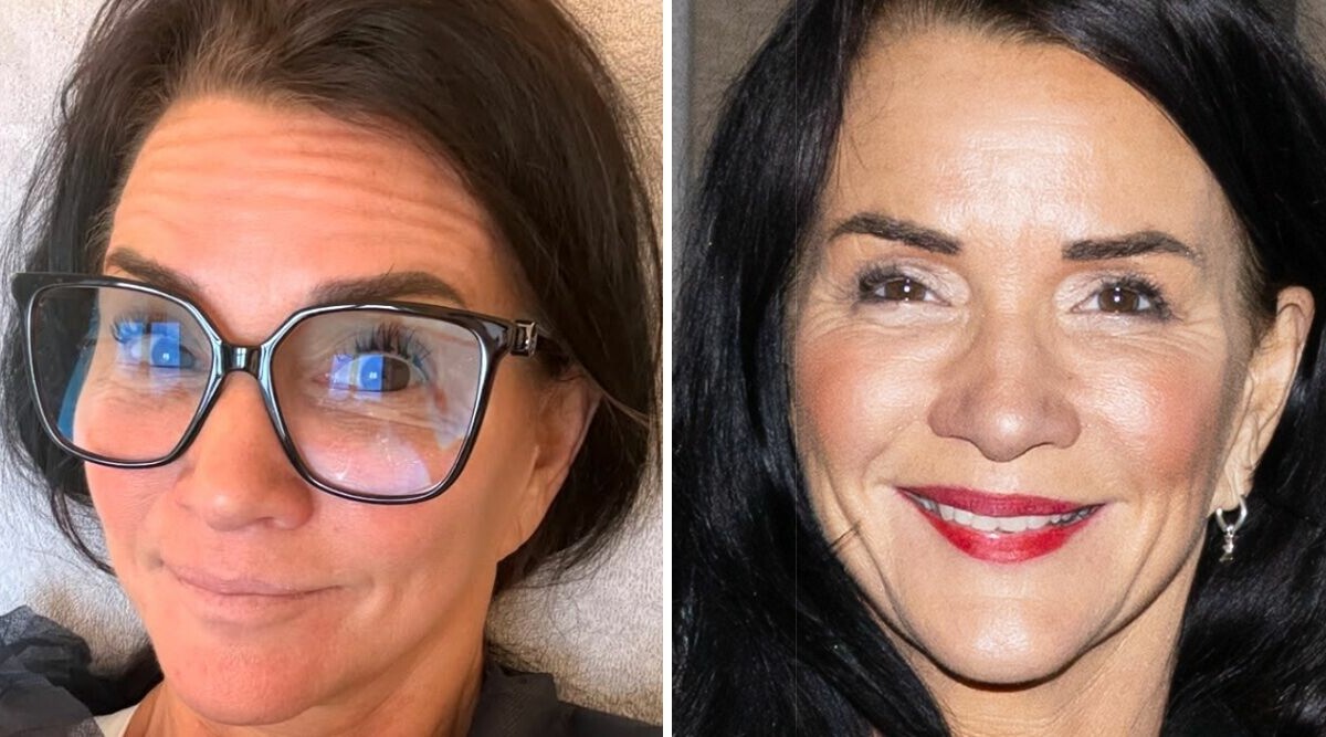 Sofia Wistams märkliga beteende på stan – efter ingreppet: "Hög som ett hus"