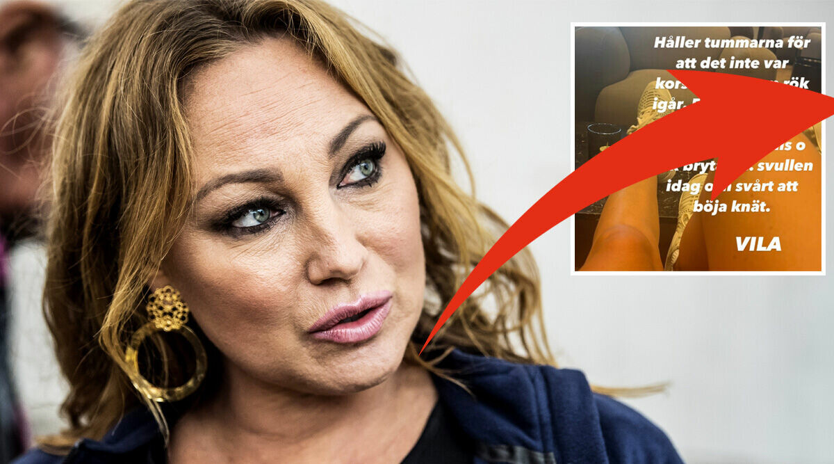 Charlotte Perrelli stoppas av smärtor – oron efter otäcka skadan: “Fick bryta”