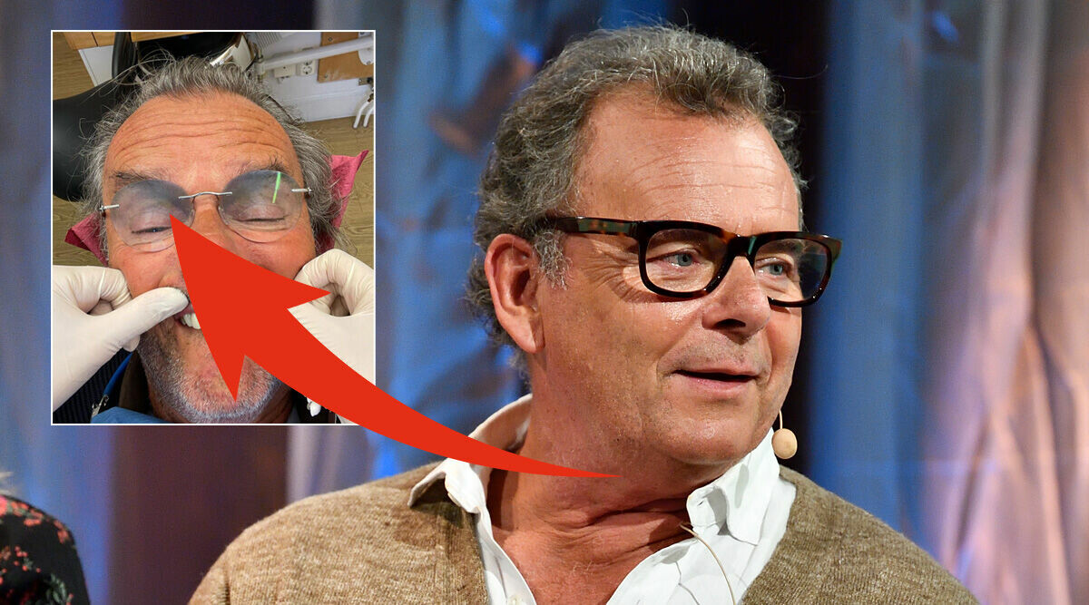 Steffo Törnquists bild väcker frågor – visar upp nya utseendet: "Tandjäveln flög ut"