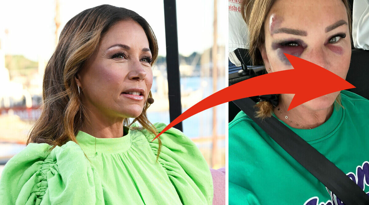 Tilde de Paulas ord efter otäcka bilderna – vännerna sluter upp