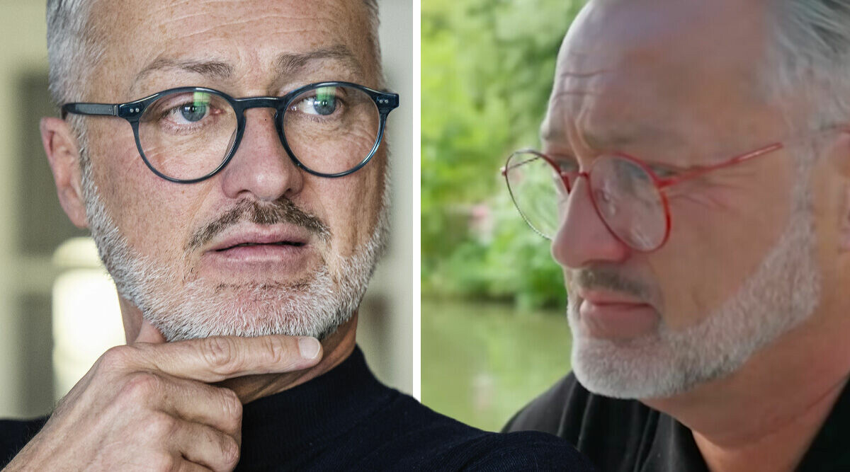 Tony Irving öppnar upp om ex-pojkvännens brutala misshandel: "Hamnade på sjukhus"