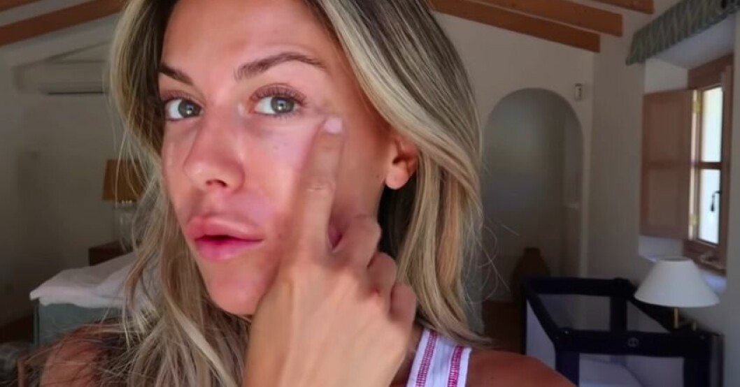 Bianca Ingrosso har testat en ny typ av filler, berättar hon! Bianca Ingrosso på Youtube
