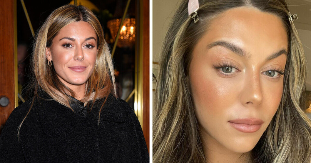 Bianca Ingrosso erkänner skönhetsingreppet – efter anklagelserna