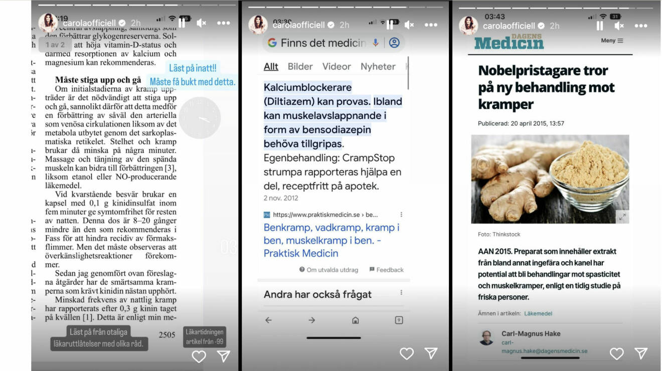 Carola Häggkvist lägger upp bilder om benkramp på Instagram