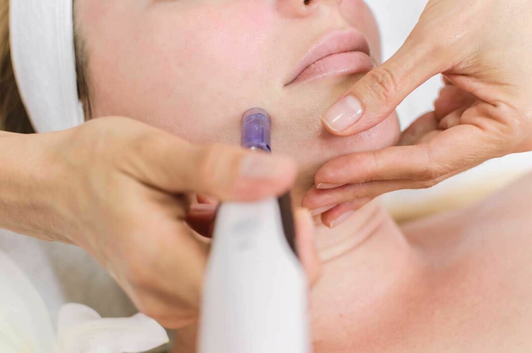 Dermapen hjälper mot fina linjer, akne ärr, strier och pigmentering. Dermapen