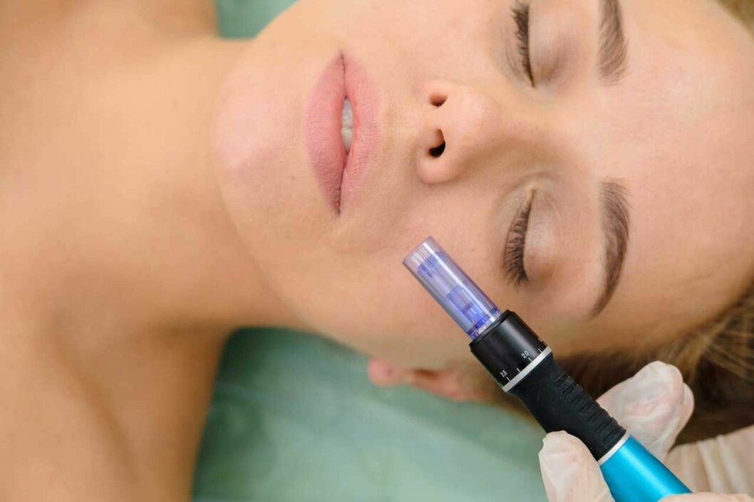 En behandling med Dermapen kostar omkring 2 000 kr. Dermapen