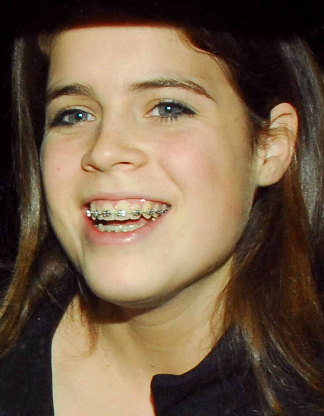 Tandställning på prinsessan Eugenie
