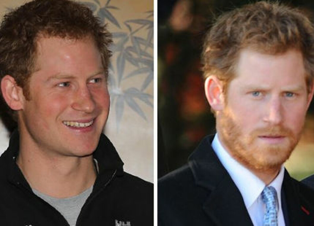 Harry-beard