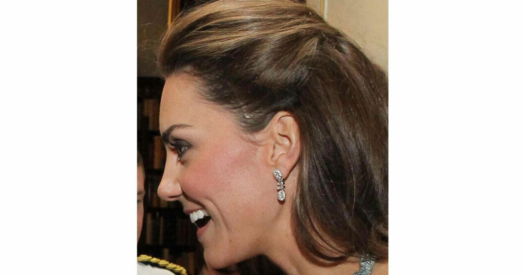 Hertiginnan Kates ärr. Kate Middleton