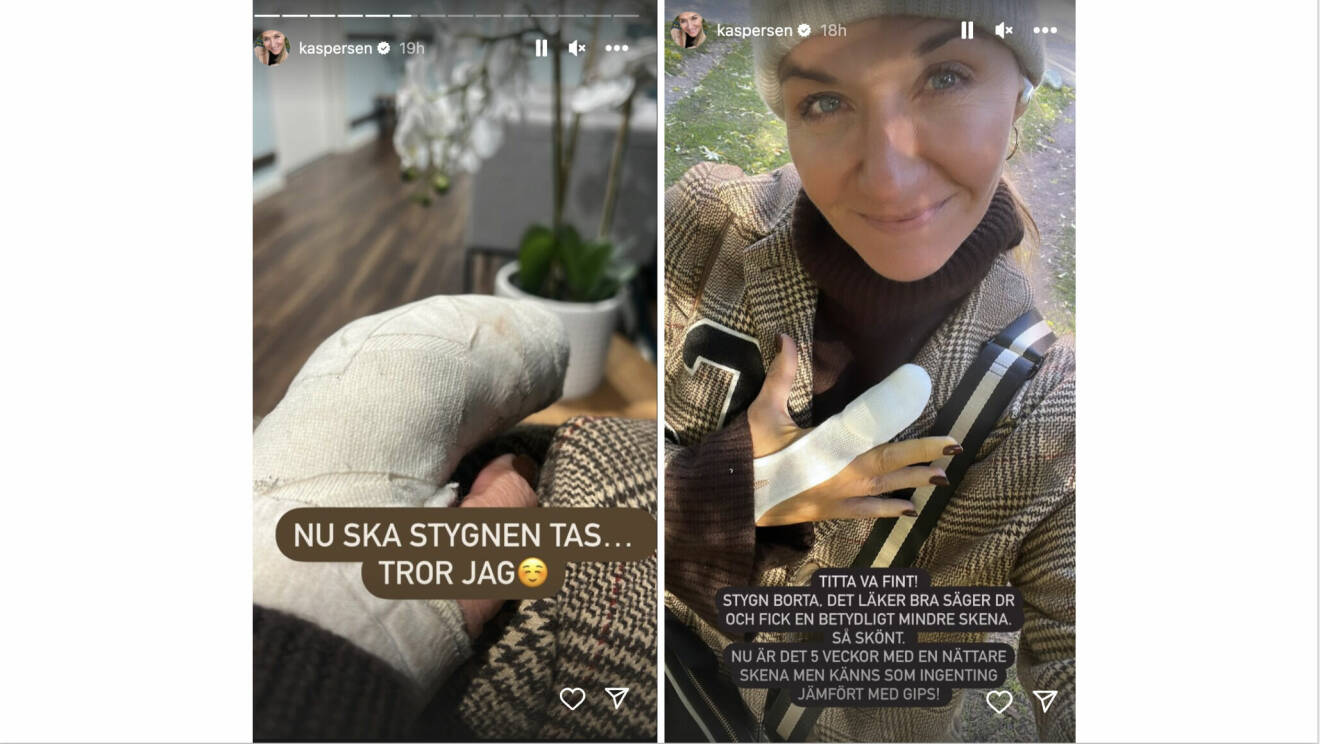 Kristin Kaspersen visar upp sin inlindade hand på Instagram