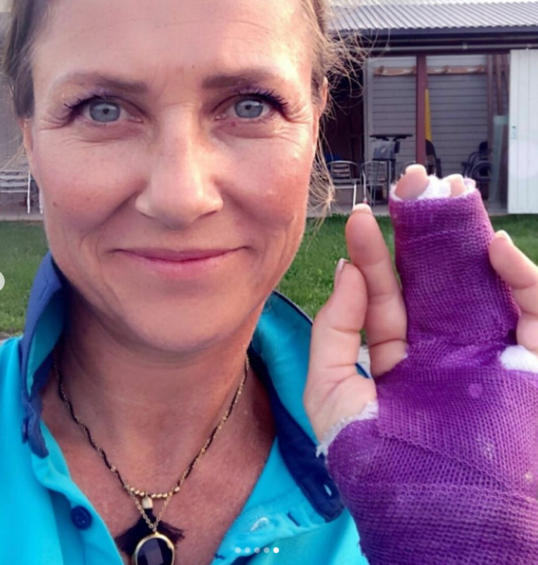 Prinsessan Märtha Louise med sitt gipsade långfinger.