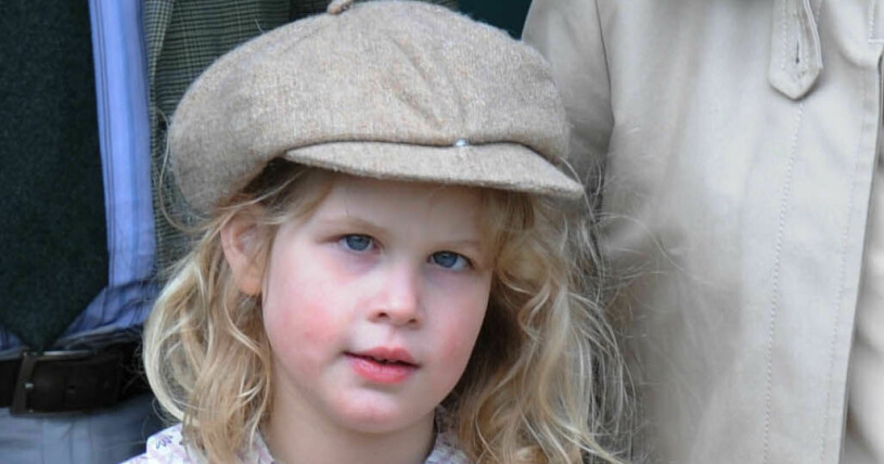 Lady Louise Windsor år 2011. Då hade ögonåkomman ännu inte lyckats behandlas. Lady Louise Windsor år 2011 då hon ännu inte lyckats korrigera sin ögonåkomma som får henne att skela