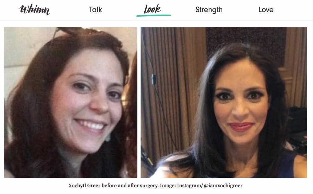 Xochytl Greer, före och efter ingreppen. Xochytl Greer, före och efter ingreppen.